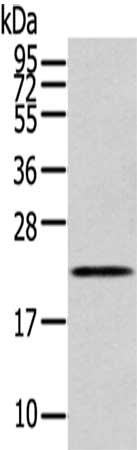 Gel: 12%SDS-PAGE,Lysate: 40 ug, Primary antibody: CSB-PA239298(RAB17 Antibody) at dilution 1/200 dilution,Secondary antibody: Goat anti rabbit IgG at 1/8000 dilution,Exposure time: 20 seconds