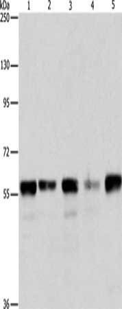Gel: 8%SDS-PAGE, Lysate: 40 ug, Lane 1-5: Hela cells, Jurkat cells, 293T cells, K562 cells, mouse testis tissue, Primary antibody: CSB-PA240267(ARIH2 Antibody) at dilution 1/550, Secondary antibody: Goat anti rabbit IgG at 1/8000 dilution, Exposure time: 40 seconds Gel: 8%SDS-PAGE, Lysate: 40 ug, Lane 1-5: Hela cells, Jurkat cells, 293T cells, K562 cells, mouse testis tissue, Primary antibody: CSB-PA240267(ARIH2 Antibody) at dilution 1/550, Secondary antibody: Goat anti rabbit IgG at 1/8000 dilution, Exposure time: 40 seconds