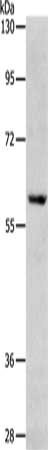 Gel: 8%SDS-PAGE, Lysate: 40 ug, Lane: Jurkat cells, Primary antibody: CSB-PA241902(RPS6KB1 Antibody) at dilution 1/200, Secondary antibody: Goat anti rabbit IgG at 1/8000 dilution, Exposure time: 1 minute