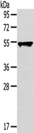 Gel: 8%SDS-PAGE,Lysate: 40 ug, Primary antibody: CSB-PA242603(TRIM10 Antibody) at dilution 1/800 dilution,Secondary antibody: Goat anti rabbit IgG at 1/8000 dilution,Exposure time: 30 seconds