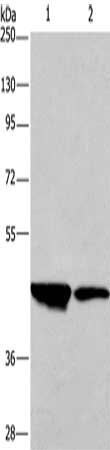 Gel: 10%SDS-PAGE, Lysate: 40 ug, Lane 1-2: Human testis tissue, Human placenta tissue, Primary antibody: CSB-PA243594(CD33 Antibody) at dilution 1/450, Secondary antibody: Goat anti rabbit IgG at 1/8000 dilution, Exposure time: 30 seconds