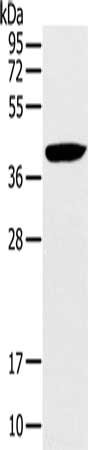 Gel: 10%SDS-PAGE, Lysate: 40 ug, Lane: Hela cells, Primary antibody: CSB-PA247431(RAD51 Antibody) at dilution 1/200, Secondary antibody: Goat anti rabbit IgG at 1/8000 dilution, Exposure time: 20 seconds