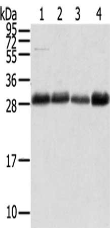 Gel: 12%SDS-PAGE,Lysate: 40 ug,Lane 1-4: A172 cells, 231 cells, Human normal stomach tissue, Hela cells,Primary antibody: CSB-PA250986(TMED1 Antibody) at dilution 1/400 dilution,Secondary antibody: Goat anti rabbit IgG at 1/8000 dilution,Exposure time: 40 seconds