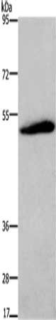 Gel: 6%SDS-PAGE, Lysate: 40 ug, Lane: Mouse brain tissue, Primary antibody: CSB-PA251074(C3AR1 Antibody) at dilution 1/200, Secondary antibody: Goat anti rabbit IgG at 1/8000 dilution, Exposure time: 10 minutes