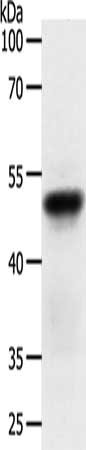 Gel: 12%SDS-PAGE, Lysate: 50 ug, Lane: Human fetal lung tissue, Primary antibody: CSB-PA269264(ACR Antibody) at dilution 1/200, Secondary antibody: Goat anti rabbit IgG at 1/8000 dilution, Exposure time: 40 seconds