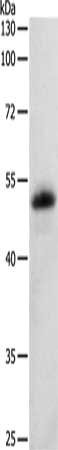 Western Blotting(WB) - SERPINF1 Antibody