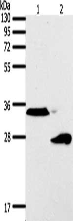 Western Blotting(WB) - SFTPA1 Antibody