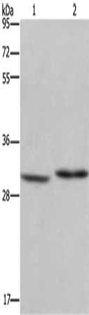 Gel: 10%SDS-PAGE, Lysate: 40 ug, Lane 1-2: Mouse liver tissue, A375 cells, Primary antibody: CSB-PA283024(DHRS3 Antibody) at dilution 1/550, Secondary antibody: Goat anti rabbit IgG at 1/8000 dilution, Exposure time: 20 seconds