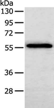 Western Blotting(WB) - SERPINF2 Antibody