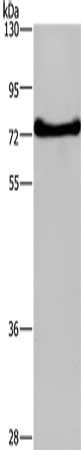 Gel: 8%SDS-PAGE, Lysate: 40 ug, Lane: HepG2 cells, Primary antibody: CSB-PA295249(DDX43 Antibody) at dilution 1/200, Secondary antibody: Goat anti rabbit IgG at 1/8000 dilution, Exposure time: 3 minutes
