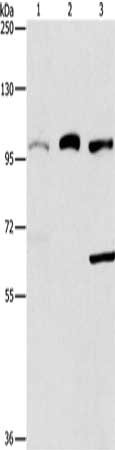 Gel: 6%SDS-PAGE, Lysate: 40 ug, Lane 1-3: 293T cells, A431 cells, hepG2 cells, Primary antibody: CSB-PA296823(ASCC2 Antibody) at dilution 1/367, Secondary antibody: Goat anti rabbit IgG at 1/8000 dilution, Exposure time: 20 seconds