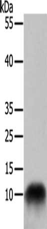 Western Blotting(WB) - COX7B Antibody