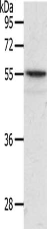 Gel: 10%SDS-PAGE, Lysate: 40 ug, Lane: Mouse intestinum tenue tissue, Primary antibody: CSB-PA337817(ANGPTL2 Antibody) at dilution 1/400, Secondary antibody: Goat anti rabbit IgG at 1/8000 dilution, Exposure time: 20 seconds