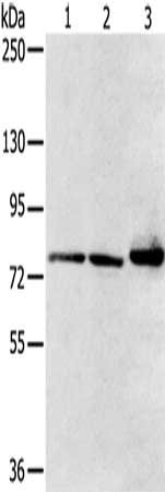 Gel: 6%SDS-PAGE, Lysate: 40 ug, Lane 1-3: Mouse heart tissue, HT29 cells, mouse liver tissue, Primary antibody: CSB-PA346002(CAPN7 Antibody) at dilution 1/300, Secondary antibody: Goat anti rabbit IgG at 1/8000 dilution, Exposure time: 1 second