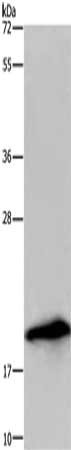 Gel: 10%SDS-PAGE, Lysate: 40 ug, Lane: U937 cells, Primary antibody: CSB-PA367981(RNASE3 Antibody) at dilution 1/200, Secondary antibody: Goat anti rabbit IgG at 1/8000 dilution, Exposure time: 3 minutes