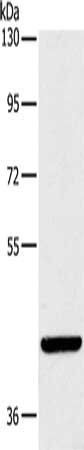 Western Blotting(WB) - LILRA1 Antibody