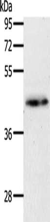 Gel: 10%SDS-PAGE, Lysate: 40 ug, Lane: Mouse brain tissue, Primary antibody: CSB-PA439945(MAP2K1 Antibody) at dilution 1/450, Secondary antibody: Goat anti rabbit IgG at 1/8000 dilution, Exposure time: 1 minute