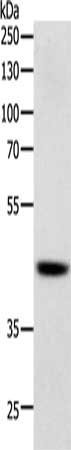Gel: 10%SDS-PAGE, Lysate: 40 ug, Lane: Human lymphoma tissue, Primary antibody: CSB-PA556897(SOX7 Antibody) at dilution 1/750, Secondary antibody: Goat anti rabbit IgG at 1/8000 dilution, Exposure time: 30 seconds