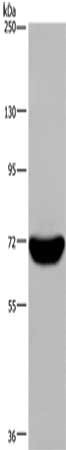 Gel: 6%SDS-PAGE, Lysate: 40 ug, Lane: Raji cells, Primary antibody: CSB-PA558619(LCP1 Antibody) at dilution 1/300, Secondary antibody: Goat anti rabbit IgG at 1/8000 dilution, Exposure time: 10 seconds