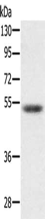 Gel: 8%SDS-PAGE, Lysate: 40 ug, Lane: Hepg2 cells, Primary antibody: CSB-PA560275(PMPCB Antibody) at dilution 1/300, Secondary antibody: Goat anti rabbit IgG at 1/8000 dilution, Exposure time: 5 seconds