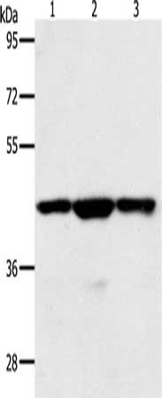Gel: 10%SDS-PAGE, Lysate: 40 ug, Lane 1-3: Jurkat cells, hela cells, K562 cells, Primary antibody: CSB-PA570222(MAP2K1 Antibody) at dilution 1/400, Secondary antibody: Goat anti rabbit IgG at 1/8000 dilution, Exposure time: 20 seconds
