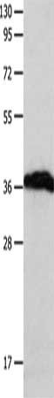 CSB-PA576070