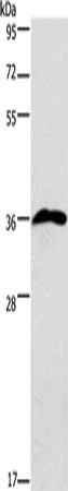 Gel: 8%SDS-PAGE, Lysate: 40 ug, Lane: 293T cells, Primary antibody: CSB-PA583001(PRPS1/2/1L1 Antibody) at dilution 1/750, Secondary antibody: Goat anti rabbit IgG at 1/8000 dilution, Exposure time: 2 minutes