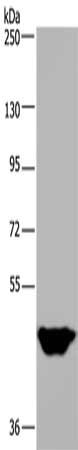 Gel: 6%SDS-PAGE, Lysate: 40 ug, Lane: Human testis tissue, Primary antibody: CSB-PA585985(MTF2 Antibody) at dilution 1/400, Secondary antibody: Goat anti rabbit IgG at 1/8000 dilution, Exposure time: 15 seconds