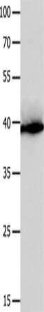 Gel: 10%SDS-PAGE, Lysate: 40 ug, Lane: Human liver cancer tissue, Primary antibody: CSB-PA589025(CFHR1 Antibody) at dilution 1/300, Secondary antibody: Goat anti rabbit IgG at 1/8000 dilution, Exposure time: 30 seconds