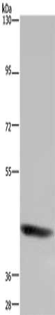 Gel: 6%SDS-PAGE, Lysate: 40 ug, Lane: Mouse heart tissue, Primary antibody: CSB-PA589811(FOXD4 Antibody) at dilution 1/200, Secondary antibody: Goat anti rabbit IgG at 1/8000 dilution, Exposure time: 5 minutes