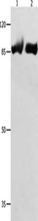 Gel: 8%SDS-PAGE, Lysate: 40 ug, Lane 1-2: Hela cells, 231 cells, Primary antibody: CSB-PA598310(IMMT Antibody) at dilution 1/250, Secondary antibody: Goat anti rabbit IgG at 1/8000 dilution, Exposure time: 1 minute