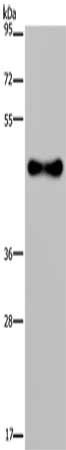 Gel: 8%SDS-PAGE, Lysate: 40 ug, Lane: Human fetal brain tissue, Primary antibody: CSB-PA607012(FADS1 Antibody) at dilution 1/300, Secondary antibody: Goat anti rabbit IgG at 1/8000 dilution, Exposure time: 10 seconds