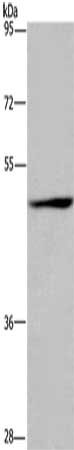 Gel: 6%SDS-PAGE, Lysate: 50 ug, Lane: Jurkat cells, Primary antibody: CSB-PA617106(SIGLEC9 Antibody) at dilution 1/350, Secondary antibody: Goat anti rabbit IgG at 1/8000 dilution, Exposure time: 30 seconds