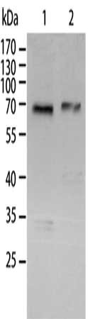 Gel: 10%SDS-PAGE, Lysate: 40 ug, Lane 1-2: A431 cells, Jurkat cells, Primary antibody: CSB-PA617153(RELA Antibody) at dilution 1/300, Secondary antibody: Goat anti rabbit IgG at 1/8000 dilution, Exposure time: 1 minute