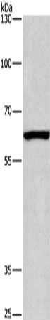 Gel: 6%SDS-PAGE, Lysate: 40 ug, Lane: Mouse testis tissue, Primary antibody: CSB-PA617569(ARMCX2 Antibody) at dilution 1/425, Secondary antibody: Goat anti rabbit IgG at 1/8000 dilution, Exposure time: 40 seconds