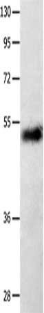 Gel: 10%SDS-PAGE, Lysate: 40 ug, Lane: Human seminoma tissue, Primary antibody: CSB-PA630217(SLC2A1 Antibody) at dilution 1/850, Secondary antibody: Goat anti rabbit IgG at 1/8000 dilution, Exposure time: 10 minutes