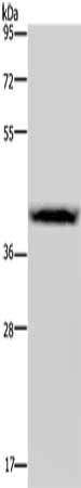 Western Blotting(WB) - CSF2RA Antibody