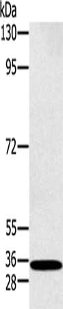 Gel: 8%SDS-PAGE, Lysate: 40 ug, Lane: K562 cells, Primary antibody: CSB-PA660209(RAB27A Antibody) at dilution 1/400, Secondary antibody: Goat anti rabbit IgG at 1/8000 dilution, Exposure time: 30 seconds