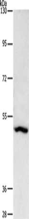 Gel: 8%SDS-PAGE, Lysate: 40 ug, Lane: A431 cells, Primary antibody: CSB-PA691151(ASB10 Antibody) at dilution 1/1650, Secondary antibody: Goat anti rabbit IgG at 1/8000 dilution, Exposure time: 2 minutes