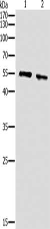 Western Blotting(WB) - AKT1 Antibody