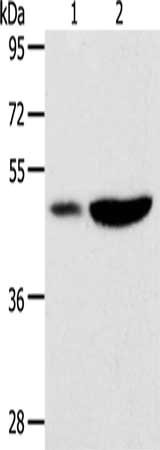 Gel: 10%SDS-PAGE, Lysate: 40 ug, Lane 1-2: Human liver cancer tissue, mouse brain tissue, Primary antibody: CSB-PA777514(PLIN2 Antibody) at dilution 1/300, Secondary antibody: Goat anti rabbit IgG at 1/8000 dilution, Exposure time: 40 seconds