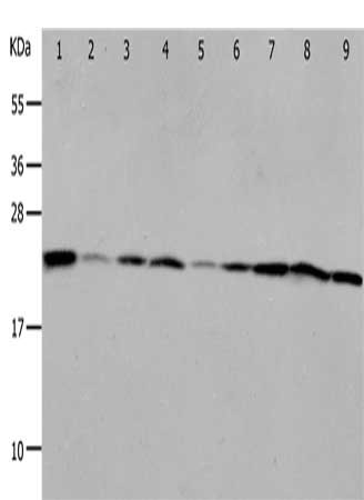 Gel: 12%SDS-PAGE, Lysate: 40 ug, Lane 1-9: Mouse liver tissue, Mouse kidney tissue, NIH/3T3 cells, RAW264.7 cells, human fetal brain tissue, 293T cells, K562 cells, Jurkat cells, Hela cells, Primary antibody: CSB-PA780249(PRDX1 Antibody) at dilution 1/400, Secondary antibody: Goat anti rabbit IgG at 1/8000 dilution, Exposure time: 50 seconds