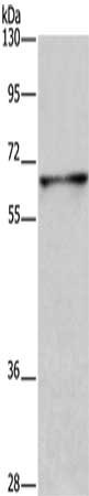 Gel: 8%SDS-PAGE, Lysate: 40 ug, Lane: Human fetal brain tissue, Primary antibody: CSB-PA780265(DPYSL3 Antibody) at dilution 1/250, Secondary antibody: Goat anti rabbit IgG at 1/8000 dilution, Exposure time: 30 seconds