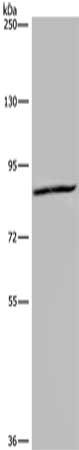 Gel: 6%SDS-PAGE, Lysate: 40 ug, Lane: Hela cells, Primary antibody: CSB-PA786029(KIF2A Antibody) at dilution 1/350, Secondary antibody: Goat anti rabbit IgG at 1/8000 dilution, Exposure time: 20 seconds