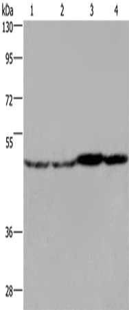 Gel: 8%SDS-PAGE, Lysate: 40 ug, Lane 1-4: Mouse liver tissue, Mouse brain tissue, Mouse heart tissue, RAW264.7 cells, Primary antibody: CSB-PA788032(FH Antibody) at dilution 1/850, Secondary antibody: Goat anti rabbit IgG at 1/8000 dilution, Exposure time: 20 seconds