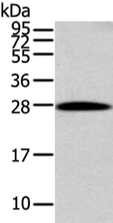 Gel: 12%SDS-PAGE, Lysate: 40 ug, Lane: Human liver cancer tissue, Primary antibody: CSB-PA792045(ZNF365 Antibody) at dilution 1/200 dilution, Secondary antibody: Goat anti rabbit IgG at 1/8000 dilution, Exposure time: 10 seconds