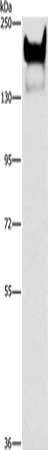 Gel: 6%SDS-PAGE, Lysate: 40 ug, Lane: Human metastatic malignant melanoma tissue, Primary antibody: CSB-PA815431(CEACAM1 Antibody) at dilution 1/300, Secondary antibody: Goat anti rabbit IgG at 1/8000 dilution, Exposure time: 20 seconds