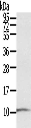 Gel: 12%SDS-PAGE, Lysate: 40 ug, Lane: A431 cells, Primary antibody: CSB-PA825365(S100P Antibody) at dilution 1/600, Secondary antibody: Goat anti rabbit IgG at 1/8000 dilution, Exposure time: 30 seconds Gel: 12%SDS-PAGE, Lysate: 40 ug, Lane: A431 cells, Primary antibody: CSB-PA825365(S100P Antibody) at dilution 1/600, Secondary antibody: Goat anti rabbit IgG at 1/8000 dilution, Exposure time: 30 seconds