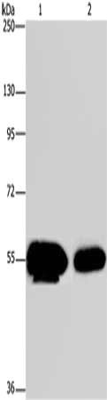 Gel: 8%SDS-PAGE, Lysate: 50 ug, Lane 1-2: Human fetal brain tissue, mouse brain tissue, Primary antibody: CSB-PA837778(APBA1 Antibody) at dilution 1/200, Secondary antibody: Goat anti rabbit IgG at 1/8000 dilution, Exposure time: 10 seconds Gel: 8%SDS-PAGE, Lysate: 50 ug, Lane 1-2: Human fetal brain tissue, mouse brain tissue, Primary antibody: CSB-PA837778(APBA1 Antibody) at dilution 1/200, Secondary antibody: Goat anti rabbit IgG at 1/8000 dilution, Exposure time: 10 seconds