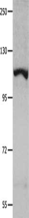 Gel: 8%SDS-PAGE, Lysate: 40 ug, Lane: K652 cells, Primary antibody: CSB-PA869336(IDE Antibody) at dilution 1/350, Secondary antibody: Goat anti rabbit IgG at 1/8000 dilution, Exposure time: 40 seconds